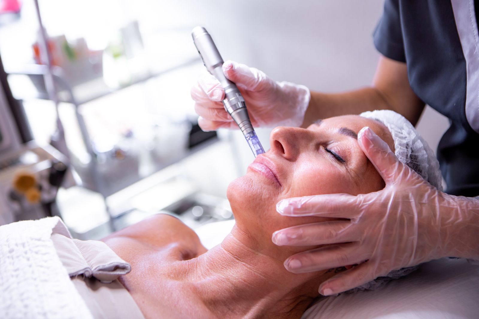 Micro-needling - Skin Hout Bay